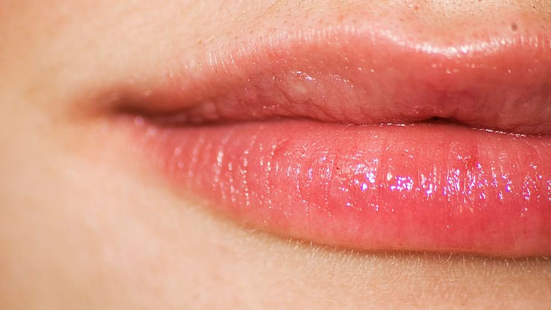 Como evitar a proliferação do vírus do herpes labial